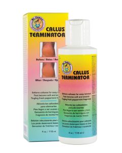 Callus Terminator